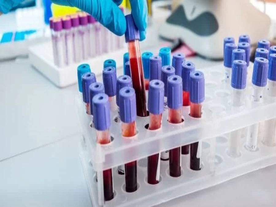 Proteína Creativa o que é o exame PCR e quais os resultados? Portal Ururau Site de Proteína Creativa o que é o exame PCR e quais os resultados? Portal Ururau Site de